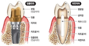yoon_dental2